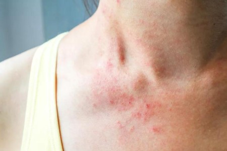 Got Skin Problems? How You Can Tell When a Specialist Is Best