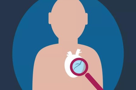 Sudden Cardiac Arrest: 5 Things Raise Your Risk