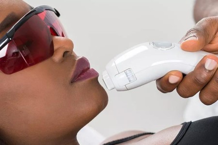 Considering Laser Hair Removal? Answers to Your 10 Best Questions