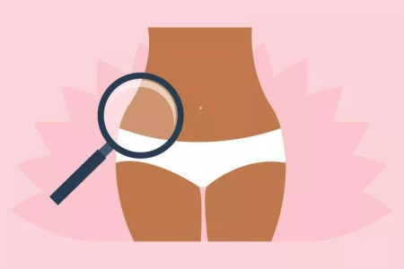 Do You Know the Difference Between a Pap Test and a Pelvic Exam?