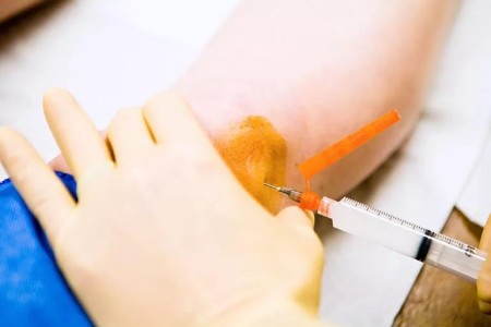 Joint Preservation vs. Replacement: What’s Your Best Option?