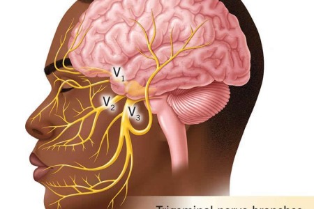 Trigeminal Nerve