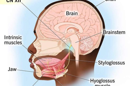 Hypoglossal Nerve