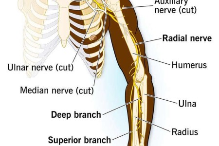 Radial Nerve