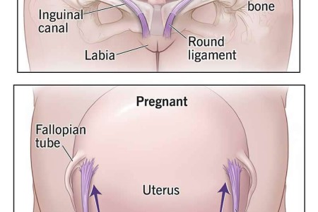 Round Ligament