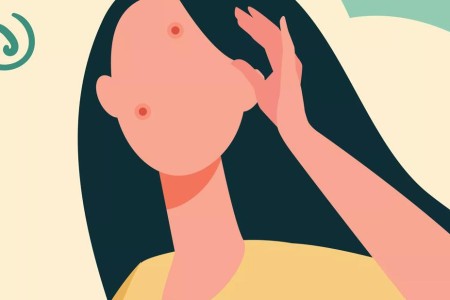 Do Pimple Patches Actually Work?