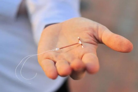 Should You Try to Remove Your Own IUD?