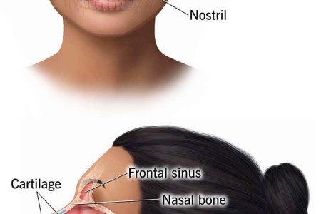 Nose