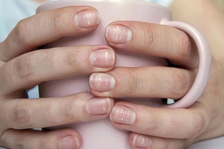 Are “COVID Nails” Real?
