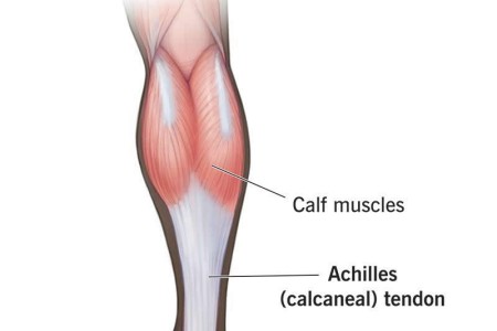 Tendon (Sinew)