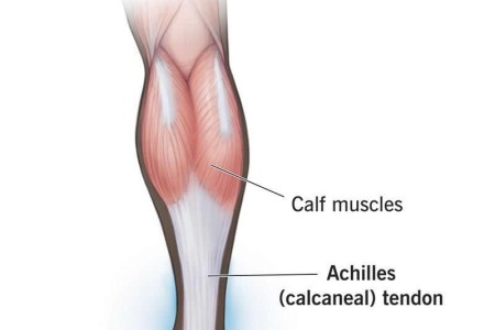 Achilles Tendon (Calcaneal Tendon)