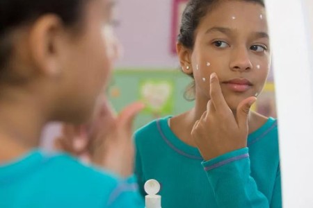 Antibiotics for Acne: How Much Is Too Much?