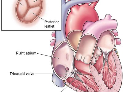 Tricuspid Valve