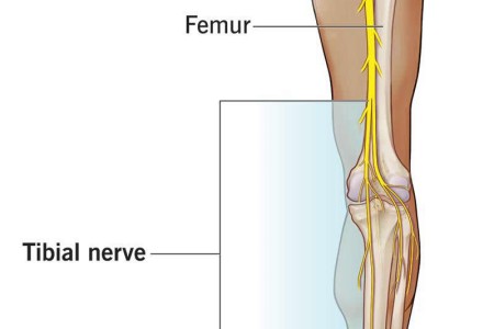 Tibial Nerve