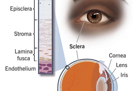Sclera (White of the Eye)