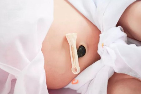 What You Should Know About Delayed Cord Clamping After Birth