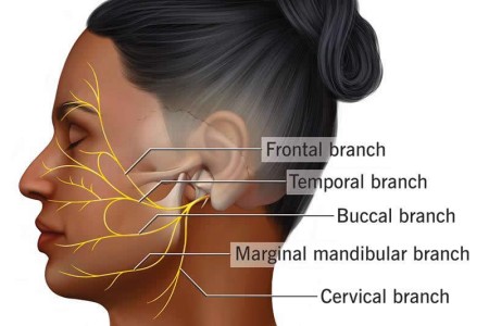 Facial Nerve