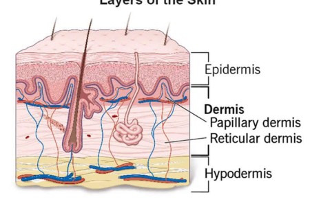 Dermis