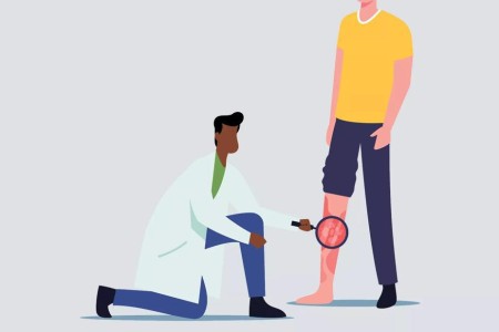 6 Blood Clot Signs You Shouldn’t Ignore