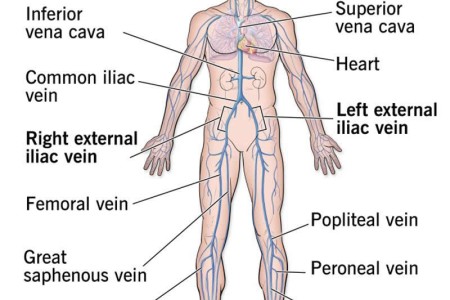 External Iliac Vein