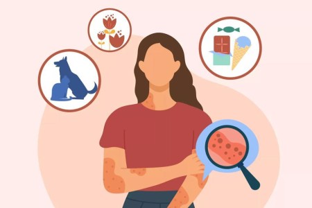 What To Do for an Allergic Reaction
