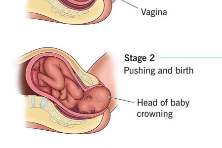 Stages of Labor