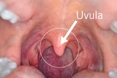 Uvula