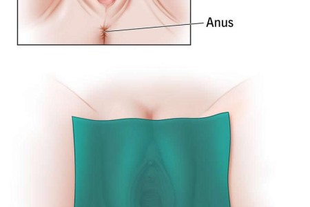 Dental Dam
