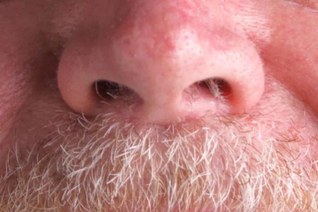 Why Nose Hairs Grow So Long
