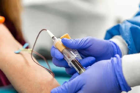 Are Rheumatoid Arthritis and Anemia Connected?