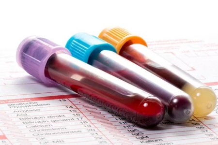 What Color Is Your Blood?
