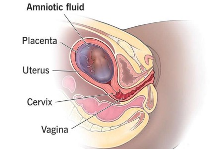 Amniotic Fluid