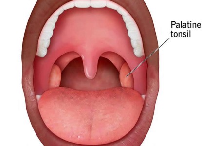 Tonsils