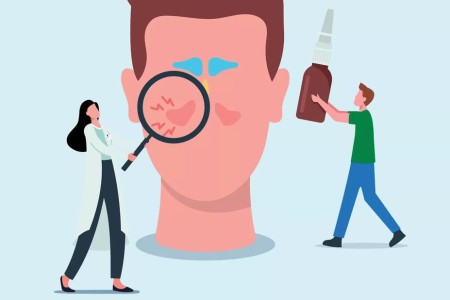 Nasal Spray for Allergies: What to Know and How to Choose