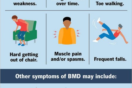 Becker Muscular Dystrophy (BMD)
