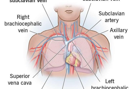 Subclavian Vein