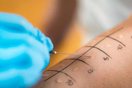 Allergist