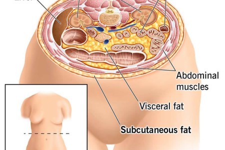 Subcutaneous Fat