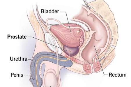 Prostate