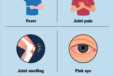 Viral Arthritis