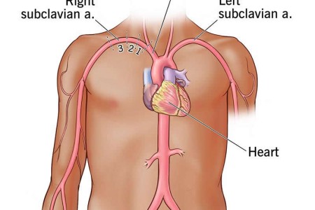 Subclavian Artery