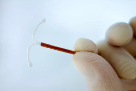 Do the Benefits of an IUD Outweigh the Potential Side Effects?