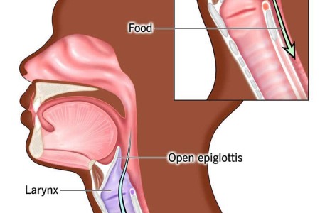 Epiglottis