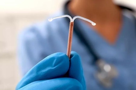 What You Need To Know About Using a Copper IUD for Birth Control