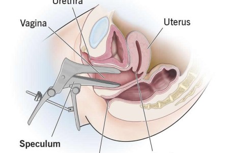 Speculum