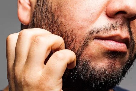 What May Be Causing Your Itchy Beard
