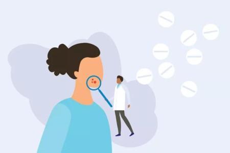 How Spironolactone Helps Hormonal Acne