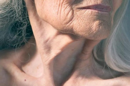 How To Get Rid of ‘Turkey Neck’