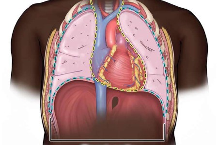 Thoracic Cavity