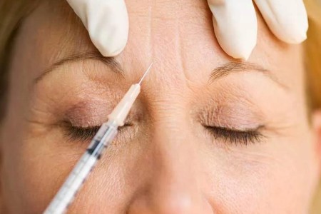 Xeomin vs. Botox, and What To Know About Both